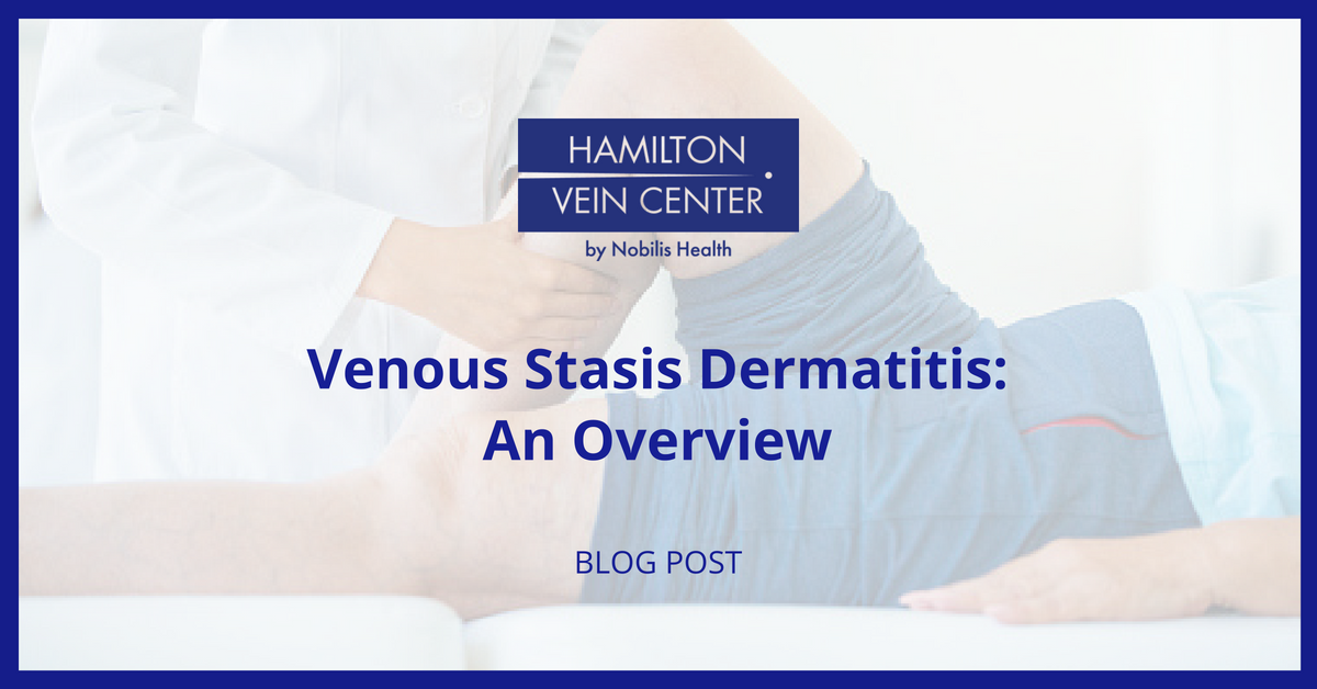 Venous Stasis Dermatitis