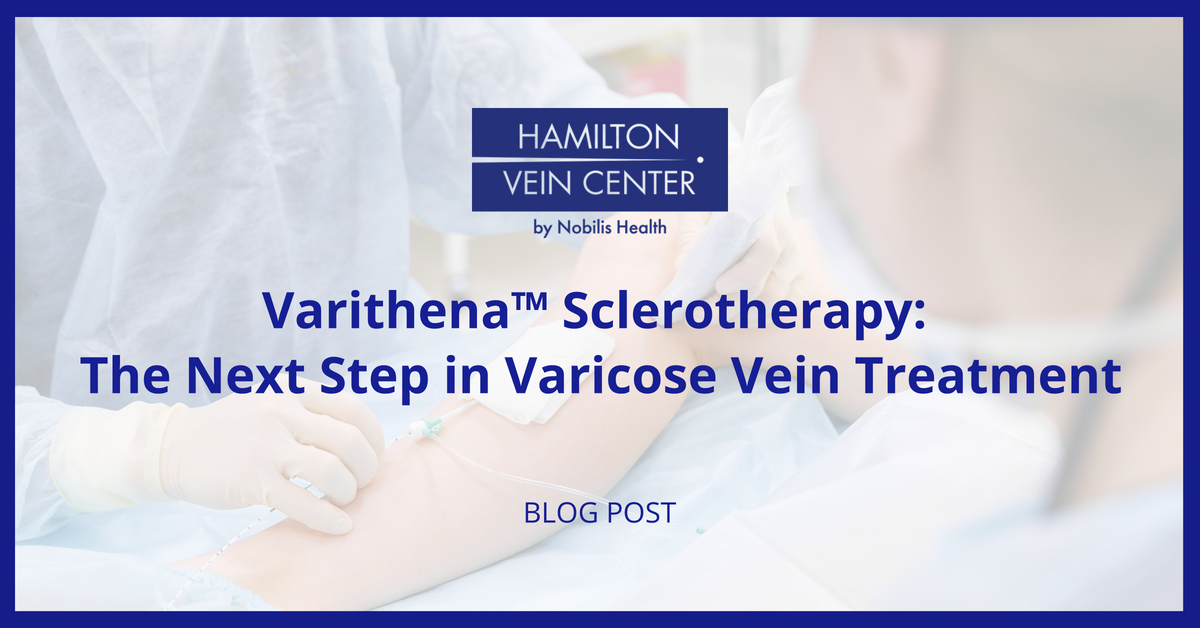 varithena sclerotherapy